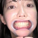 【歯・口内】アイドルの激レアな舌、のどちんこ、歯観察プレイ 宇佐美みおん